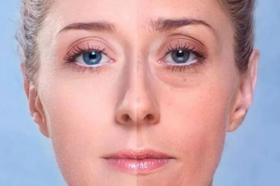 Espalda debajo de los ojos